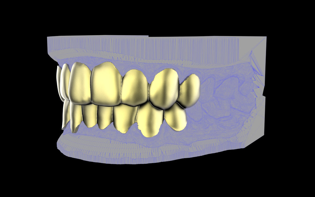 Custom Grillz & Tooth Caps - Plain Jane