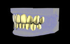 Custom Grillz & Tooth Caps - Plain Jane