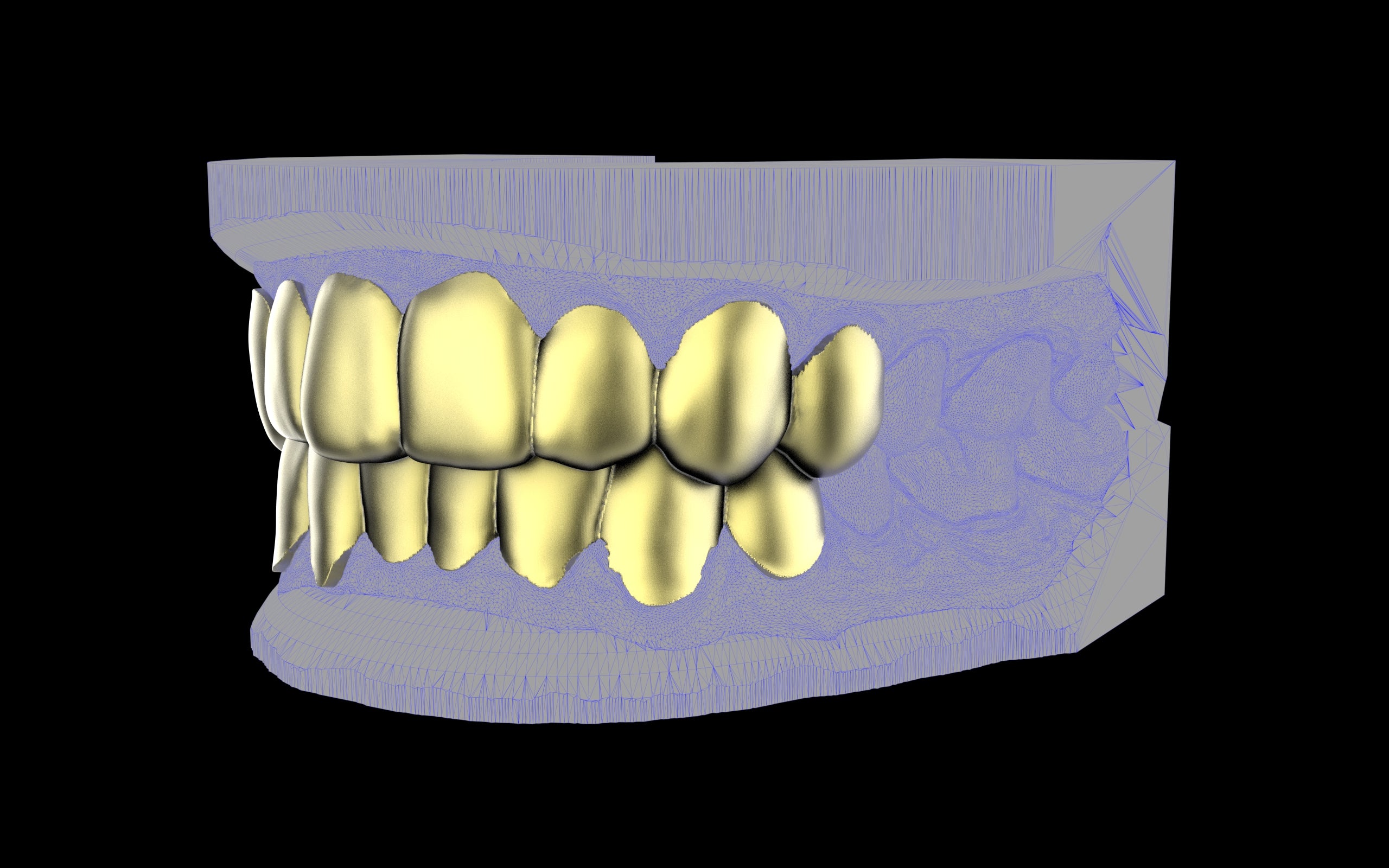 Custom Grillz & Tooth Caps - Plain Jane