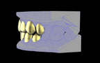 Custom Grillz & Tooth Caps - Plain Jane