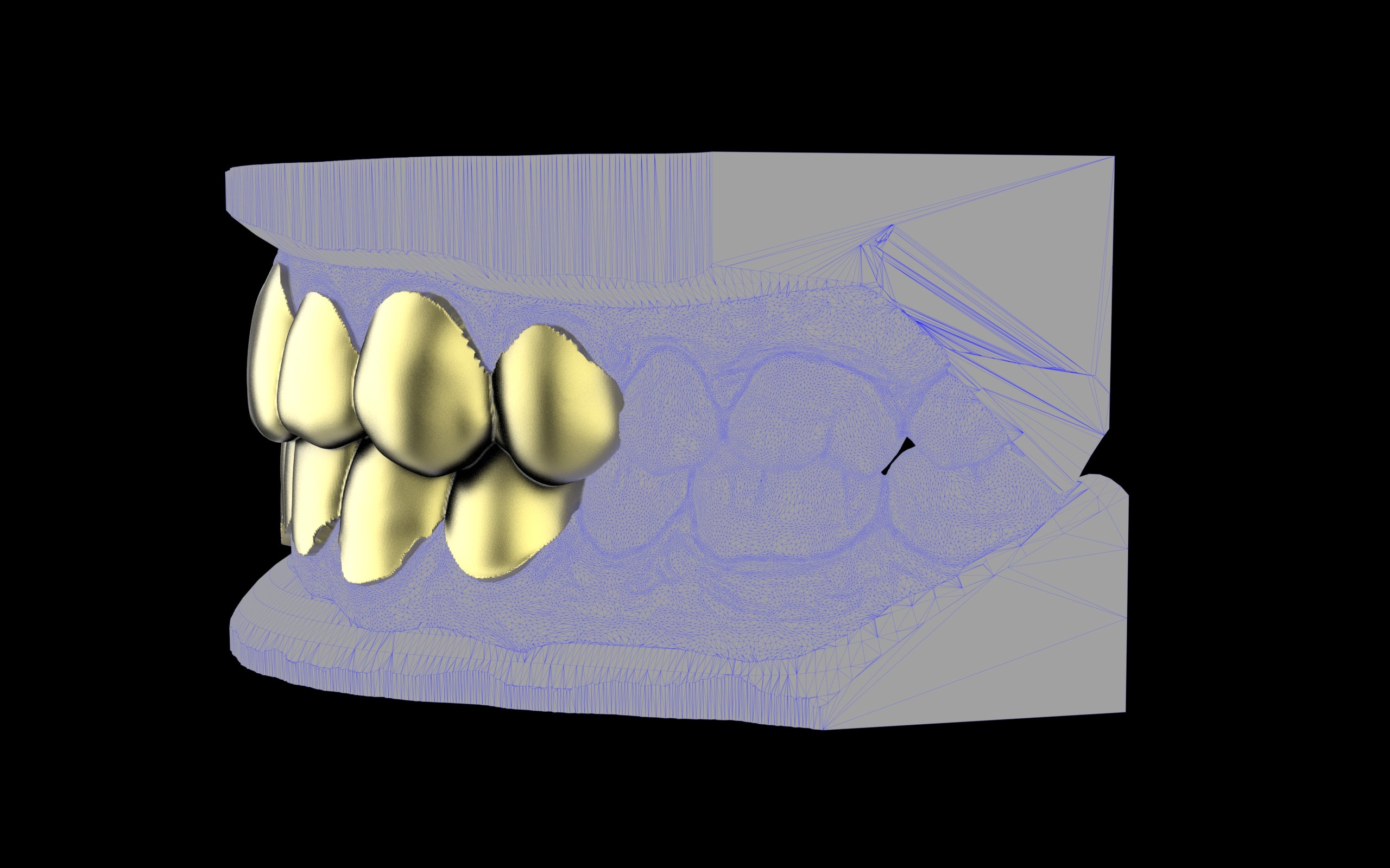 Custom Grillz & Tooth Caps - Plain Jane