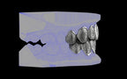 Custom Grillz & Tooth Caps - Dynasty Cut