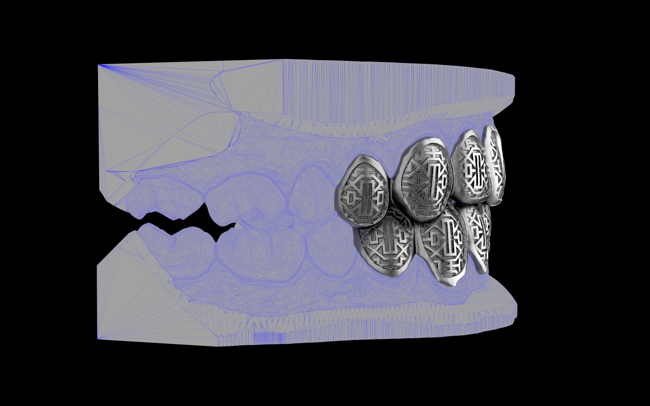 Custom Grillz & Tooth Caps - Dynasty Cut