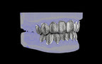 Custom Grillz & Tooth Caps - Dynasty Cut