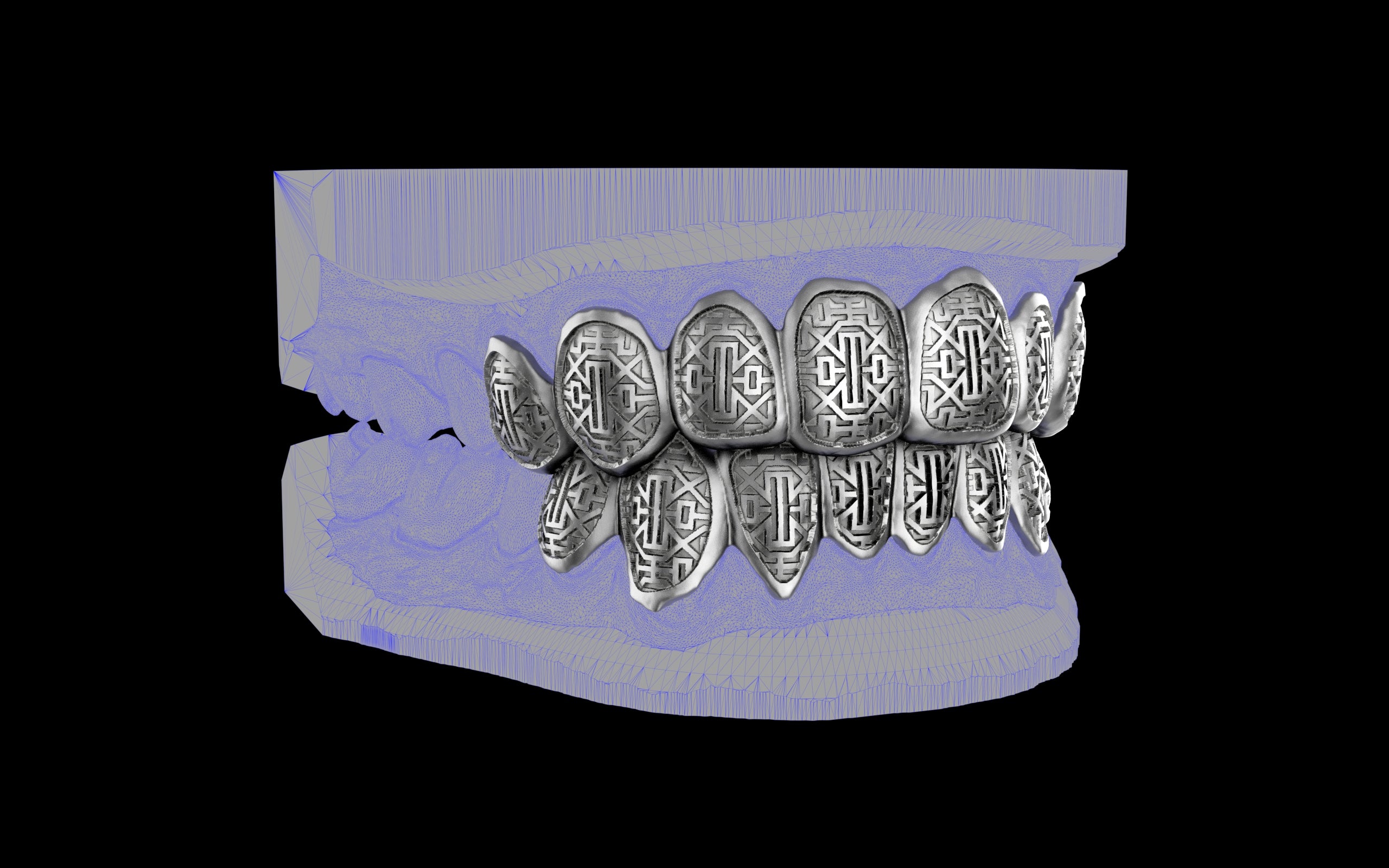 Custom Grillz & Tooth Caps - Dynasty Cut