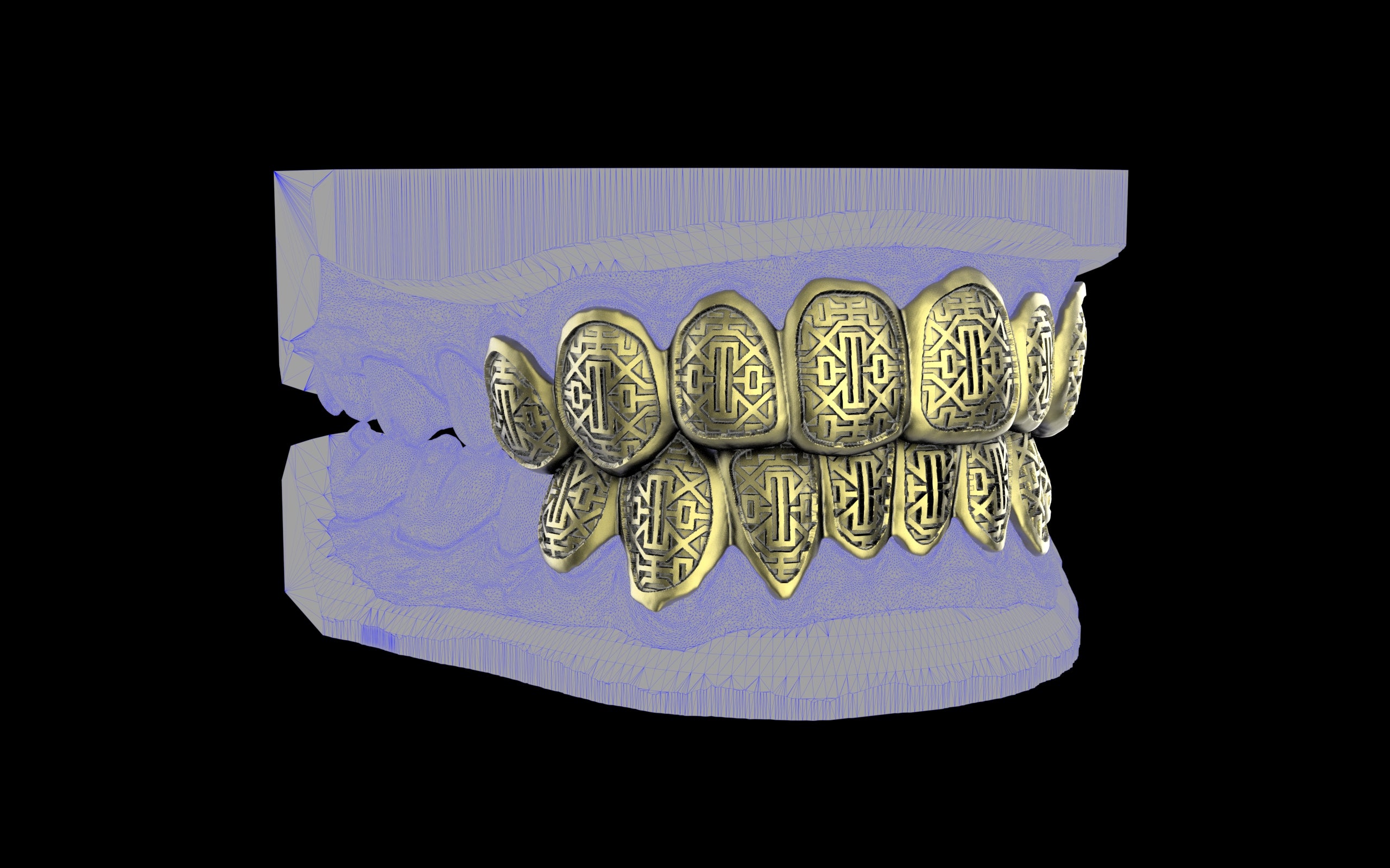 Custom Grillz & Tooth Caps - Dynasty Cut