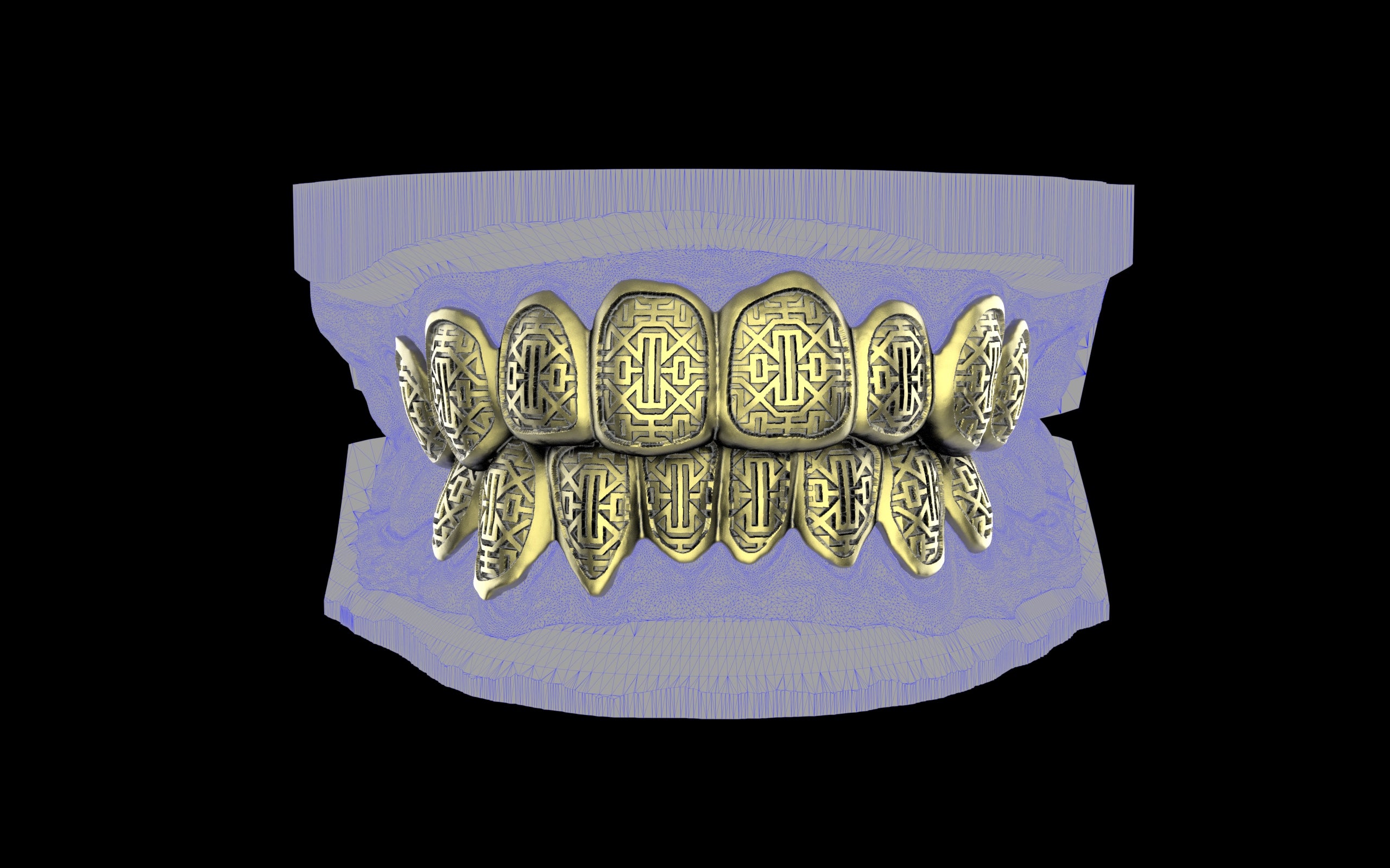 Custom Grillz & Tooth Caps - Dynasty Cut