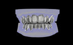 Custom Grillz & Tooth Caps - Dynasty Cut