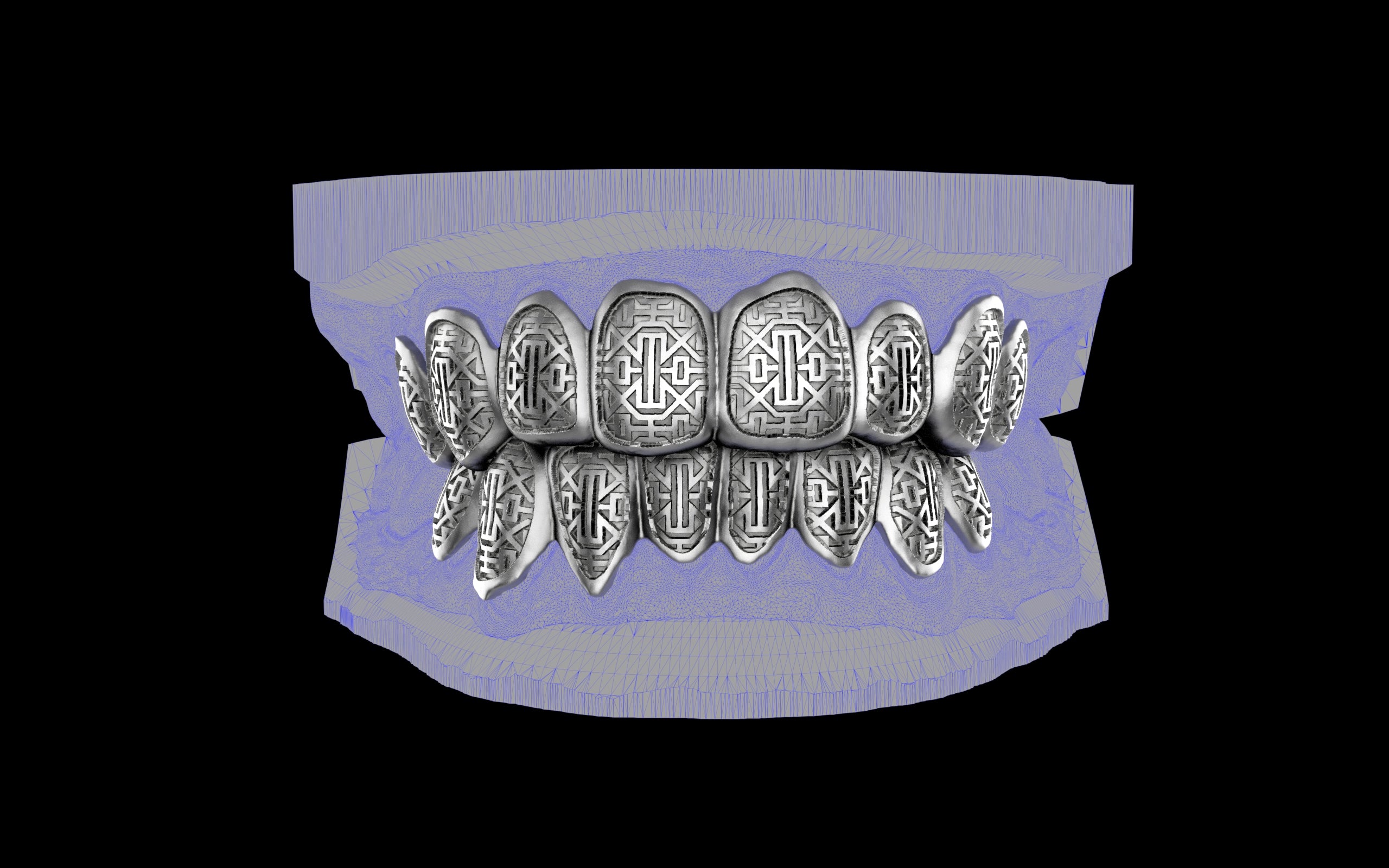 Custom Grillz & Tooth Caps - Dynasty Cut