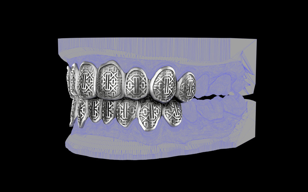 Custom Grillz & Tooth Caps - Dynasty Cut
