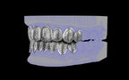 Custom Grillz & Tooth Caps - Dynasty Cut