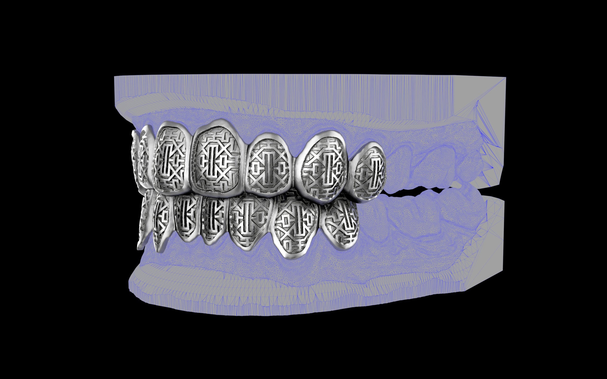 Custom Grillz & Tooth Caps - Dynasty Cut