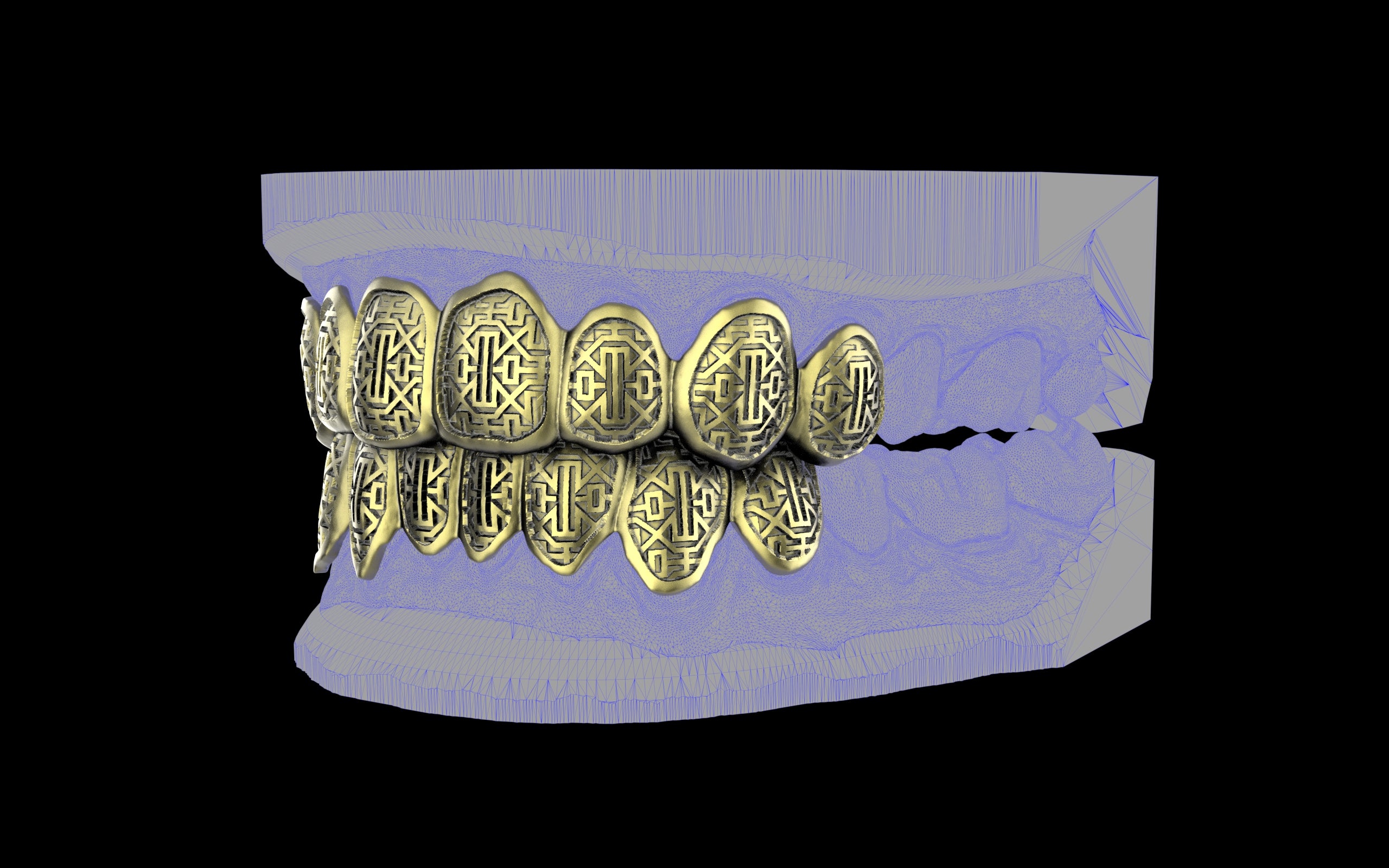 Custom Grillz & Tooth Caps - Dynasty Cut