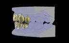 Custom Grillz & Tooth Caps - Dynasty Cut
