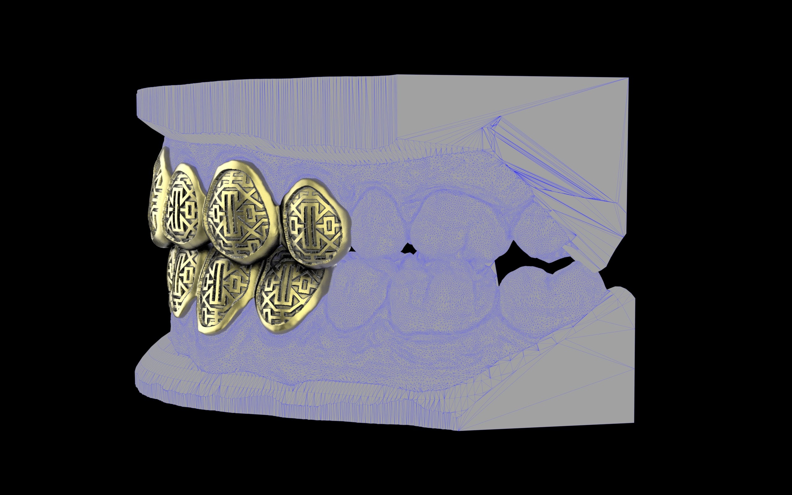 Custom Grillz & Tooth Caps - Dynasty Cut