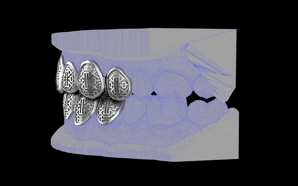 Custom Grillz & Tooth Caps - Dynasty Cut