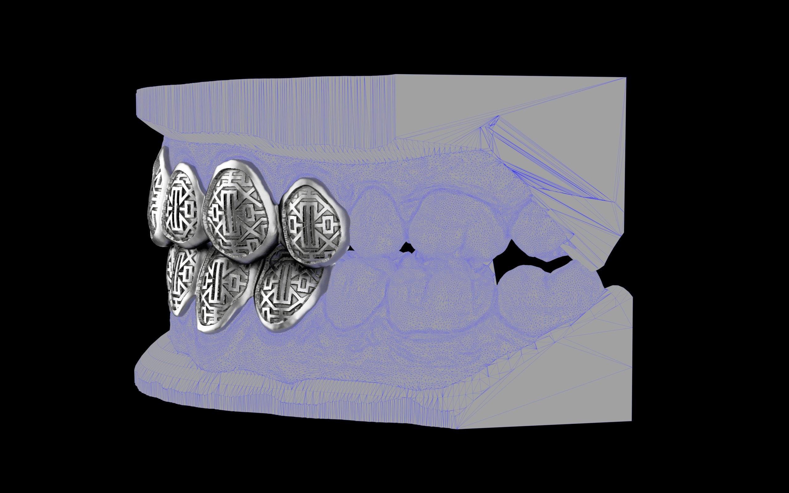 Custom Grillz & Tooth Caps - Dynasty Cut