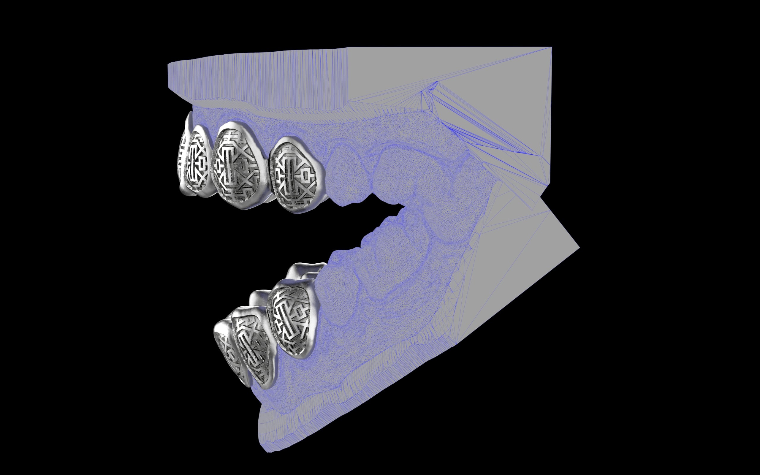 Custom Grillz & Tooth Caps - Dynasty Cut