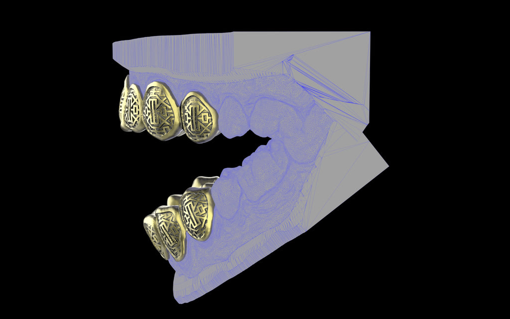 Custom Grillz & Tooth Caps - Dynasty Cut