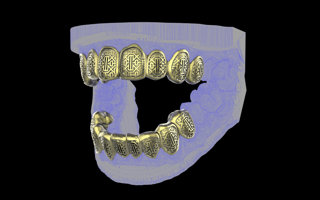 Custom Grillz & Tooth Caps - Dynasty Cut