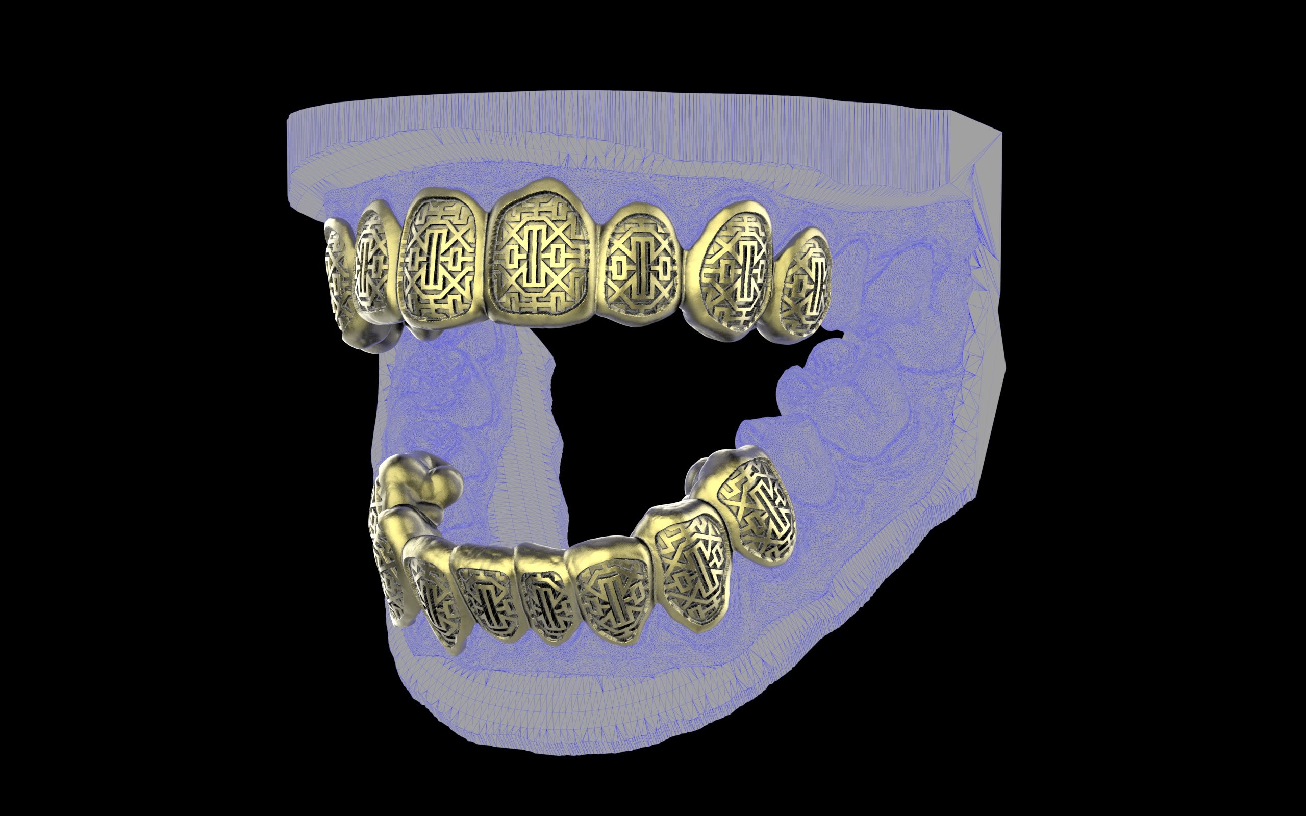 Custom Grillz & Tooth Caps - Dynasty Cut