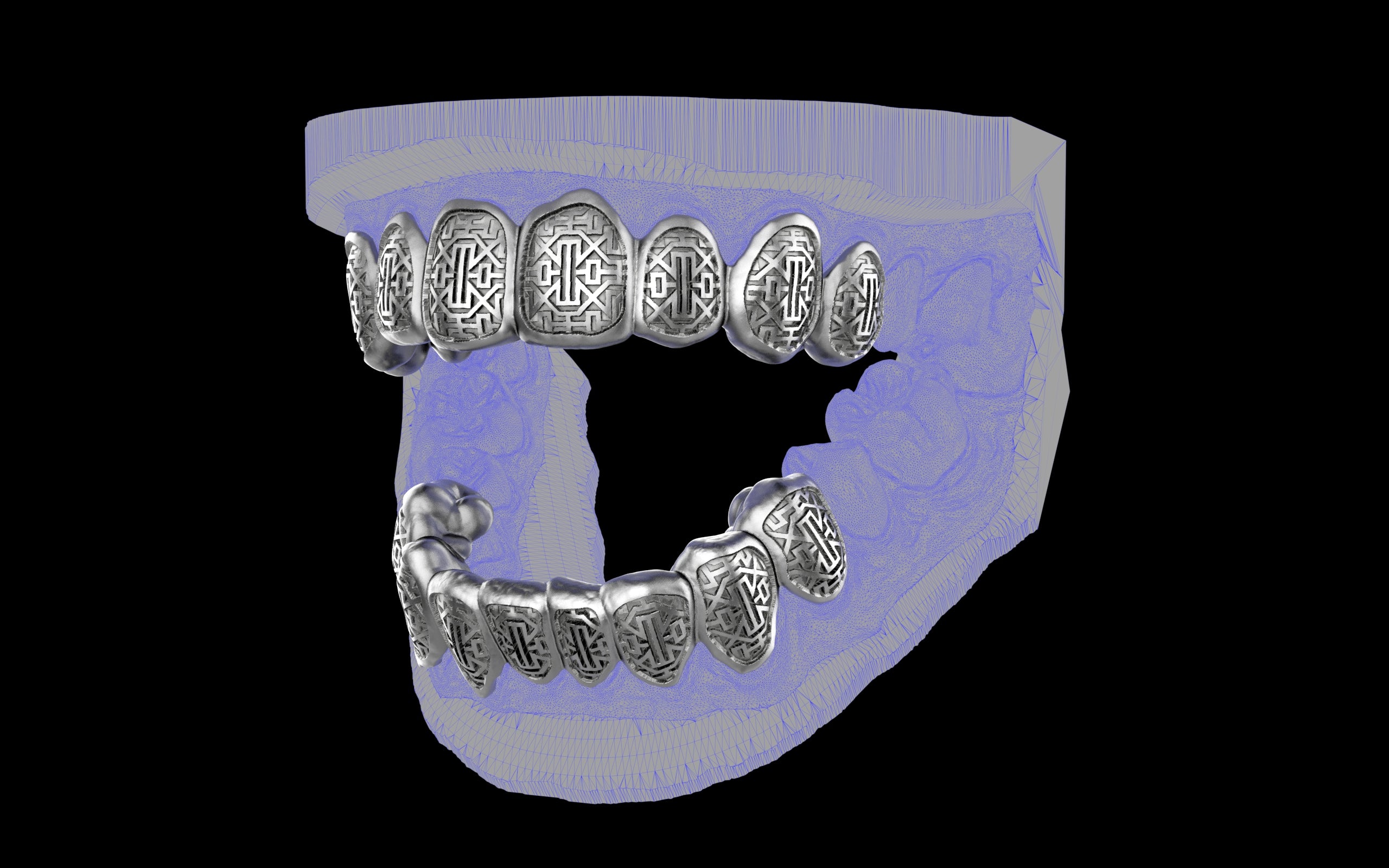 Custom Grillz & Tooth Caps - Dynasty Cut