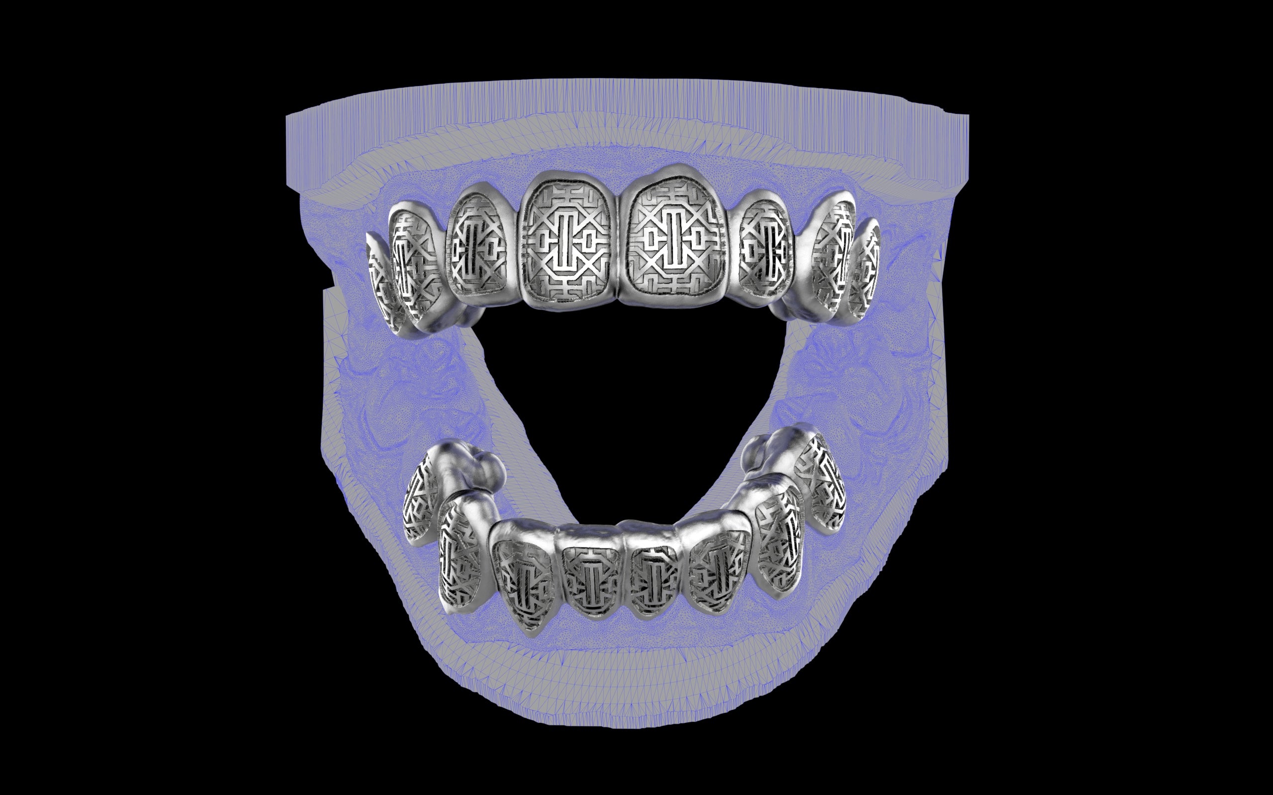 Custom Grillz & Tooth Caps - Dynasty Cut