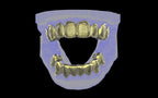 Custom Grillz & Tooth Caps - Dynasty Cut