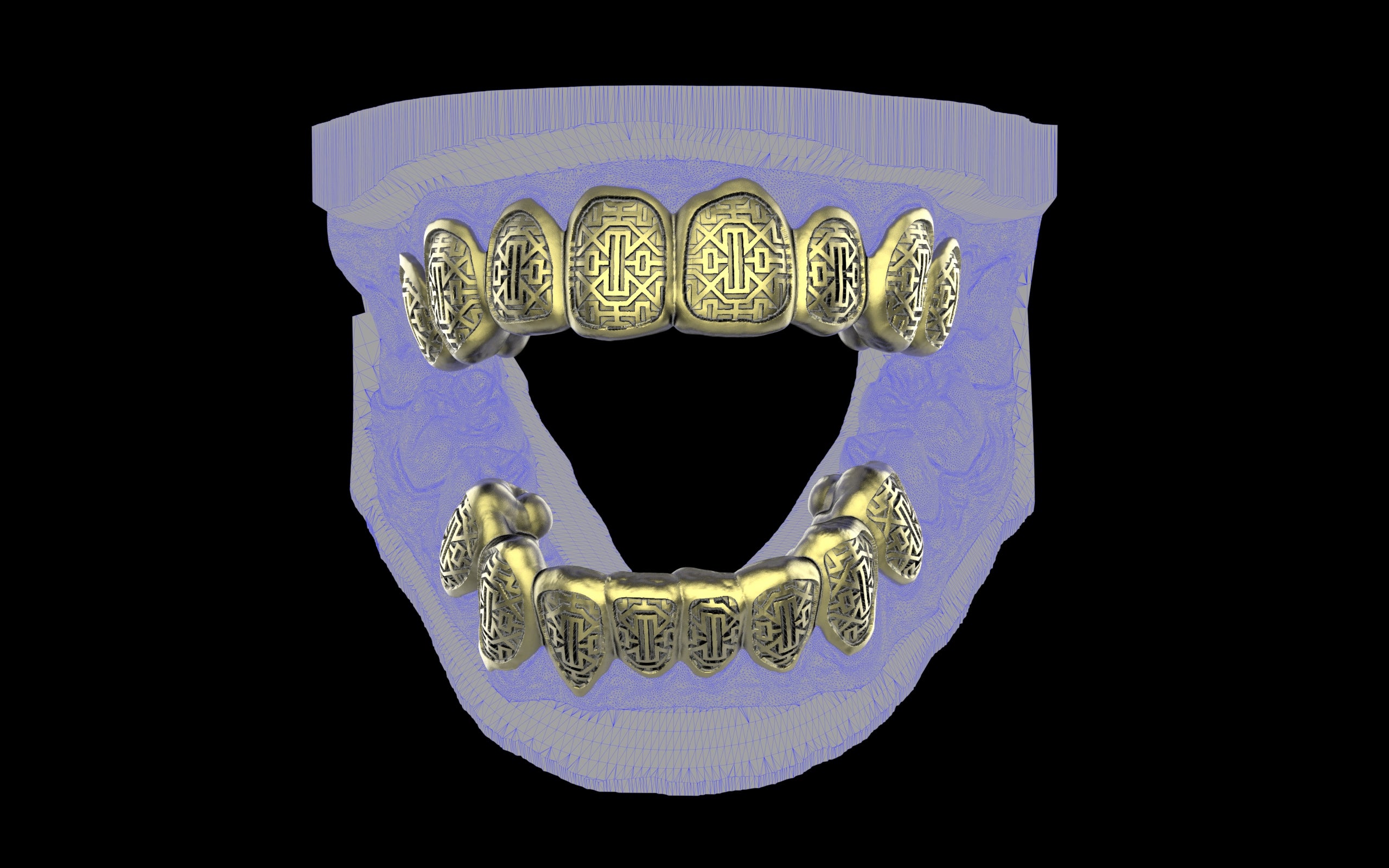 Custom Grillz & Tooth Caps - Dynasty Cut