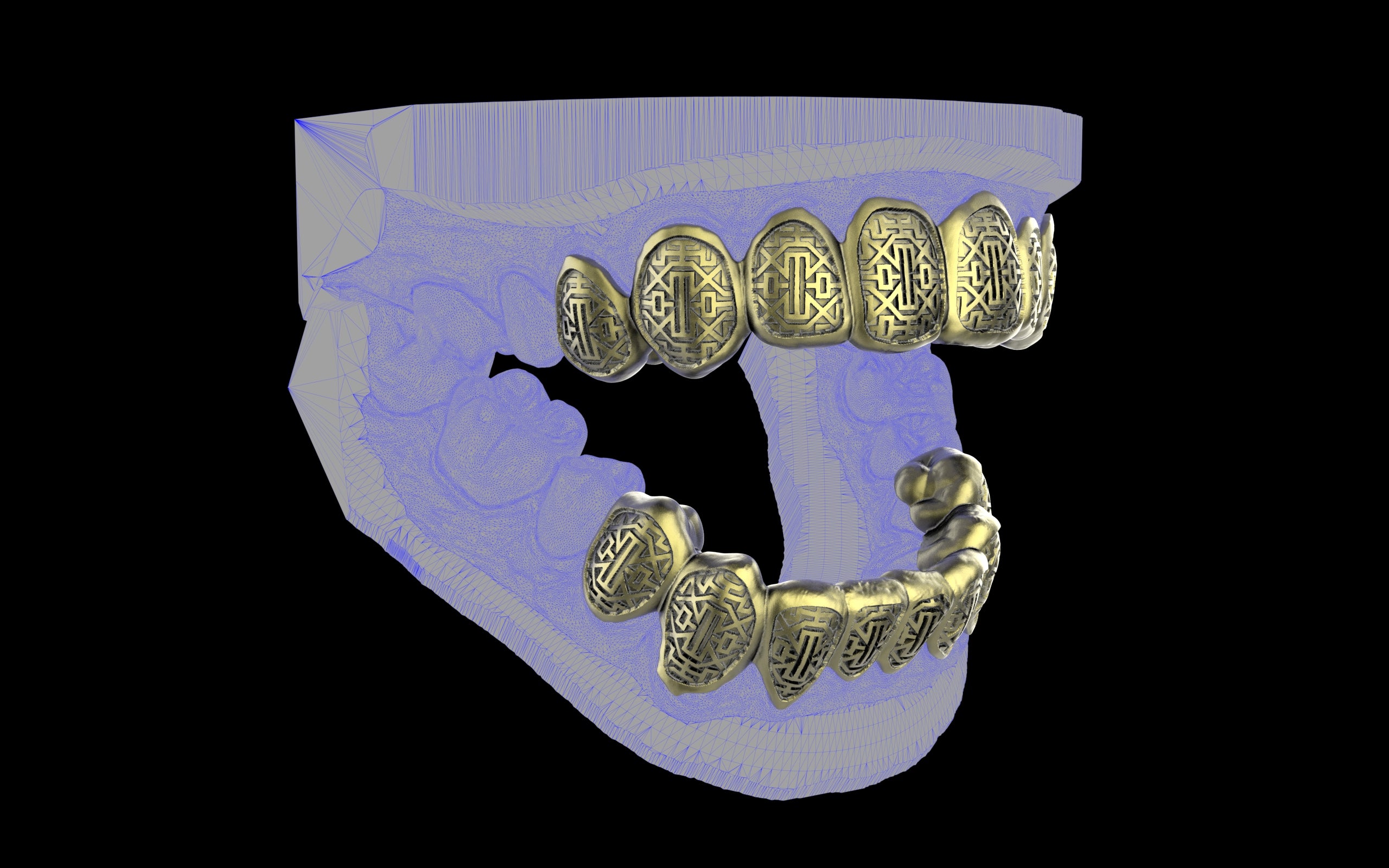 Custom Grillz & Tooth Caps - Dynasty Cut