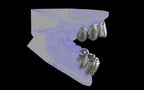 Custom Grillz & Tooth Caps - Dynasty Cut