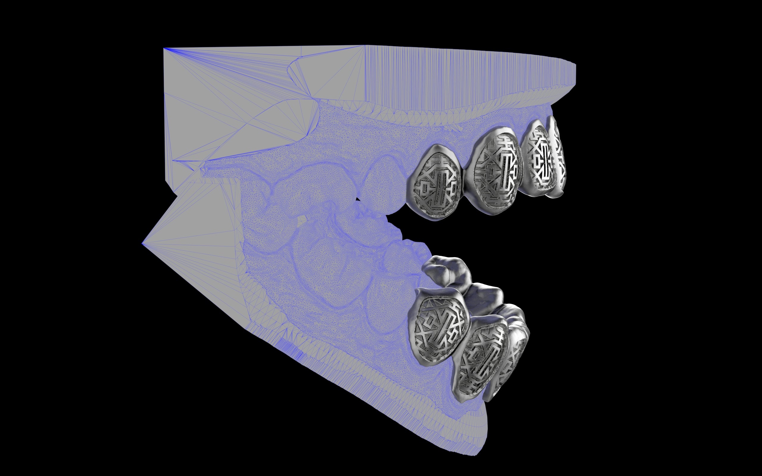 Custom Grillz & Tooth Caps - Dynasty Cut