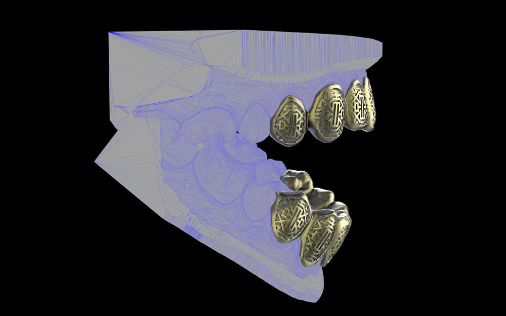 Custom Grillz & Tooth Caps - Dynasty Cut
