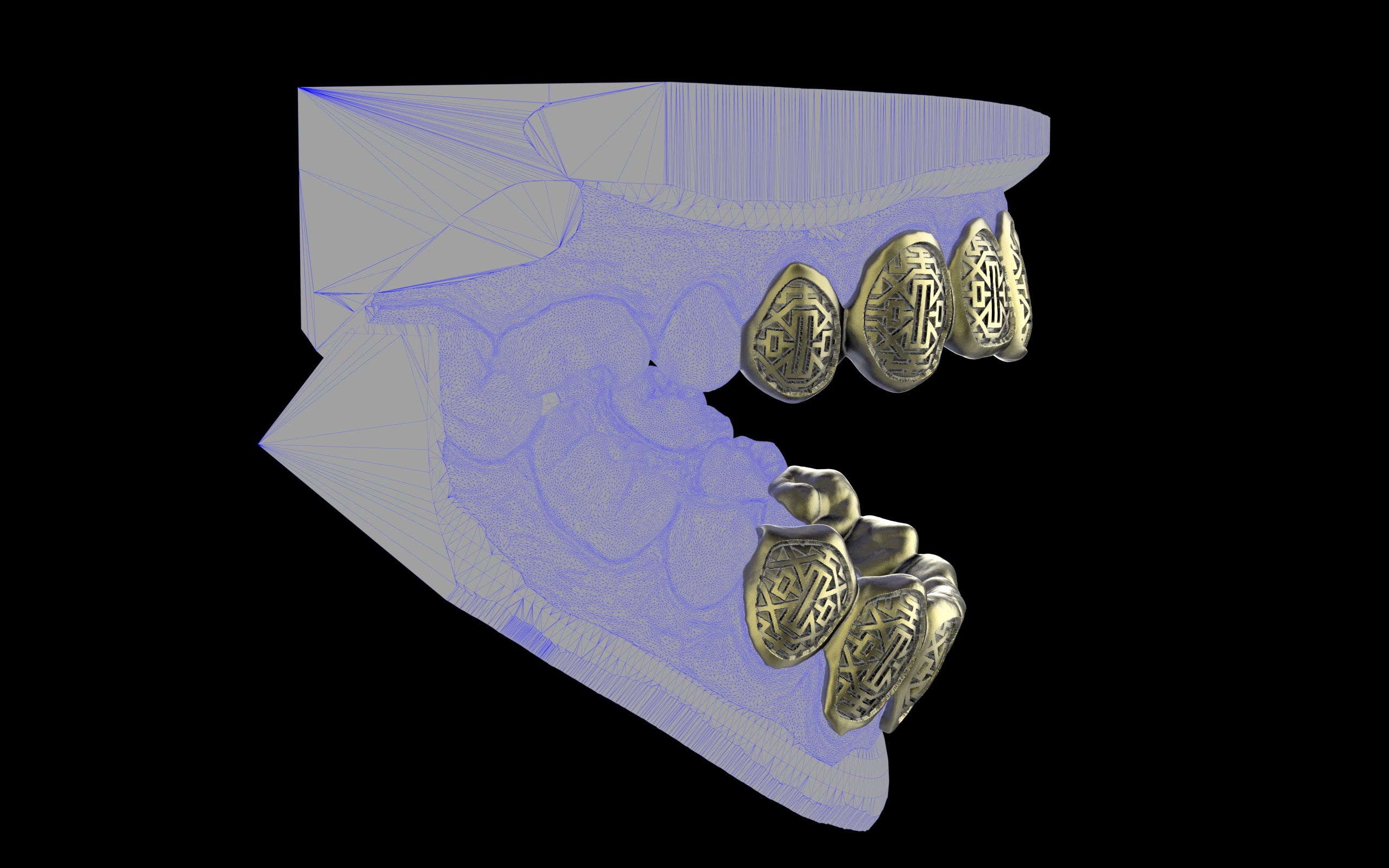 Custom Grillz & Tooth Caps - Dynasty Cut