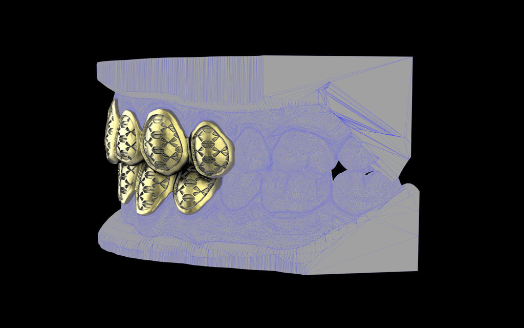 Custom Grillz / Tooth Caps - Funktion One