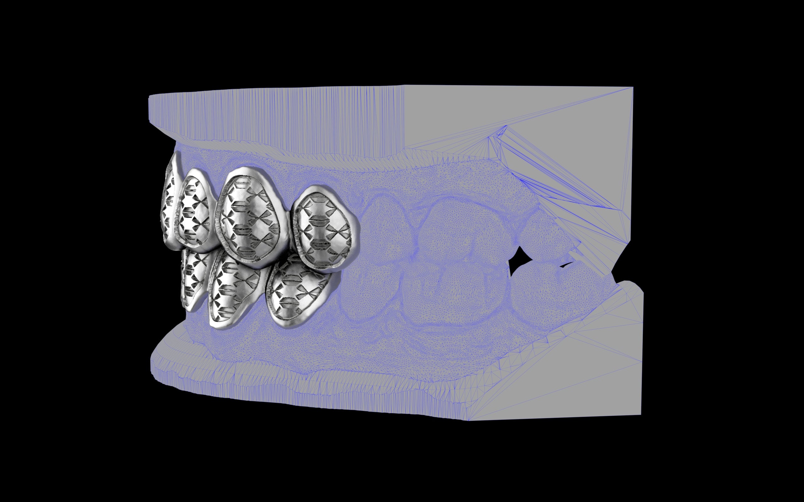 Custom Grillz / Tooth Caps - Funktion One