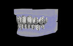 Custom Grillz / Tooth Caps - Funktion One