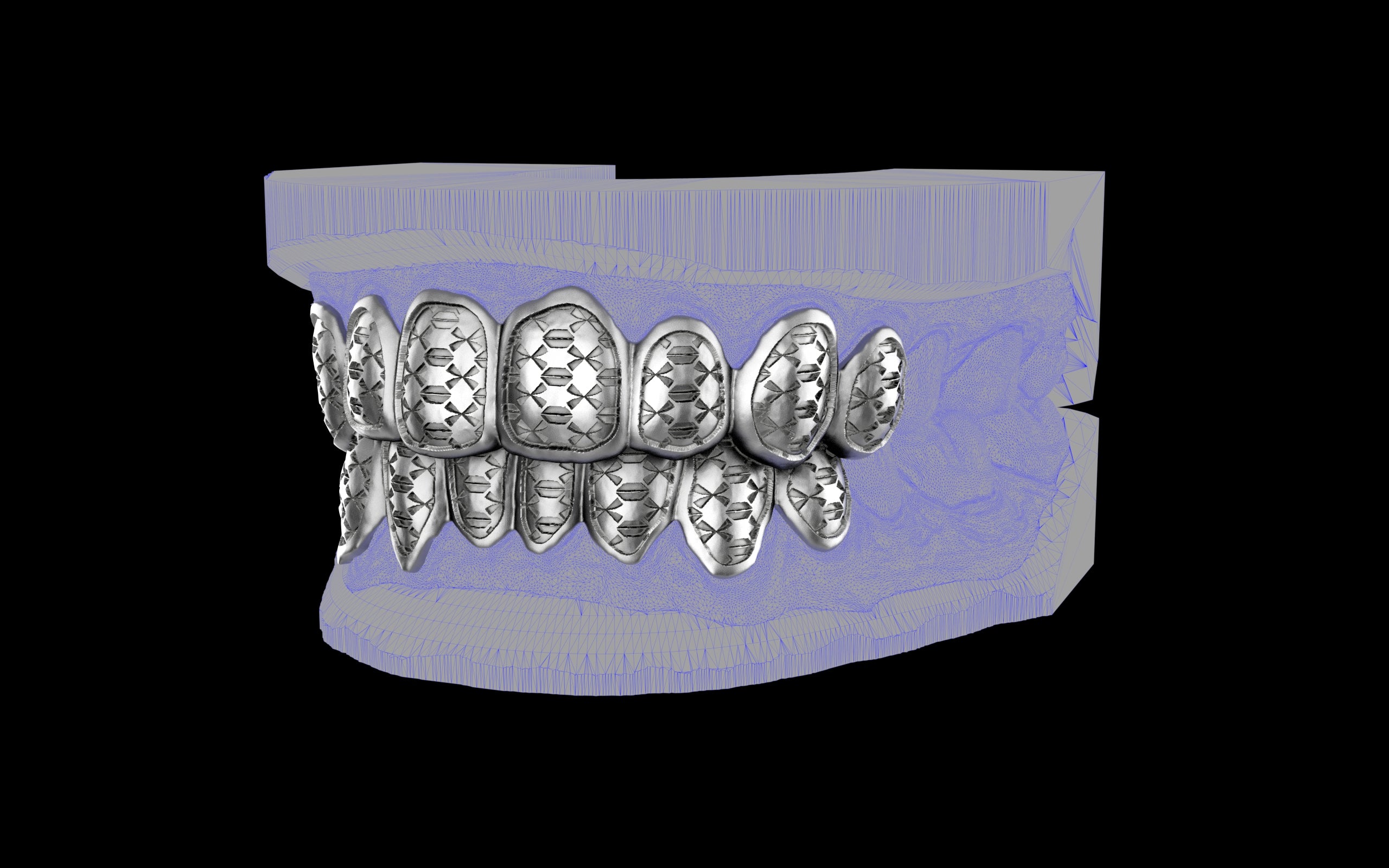 Custom Grillz / Tooth Caps - Funktion One