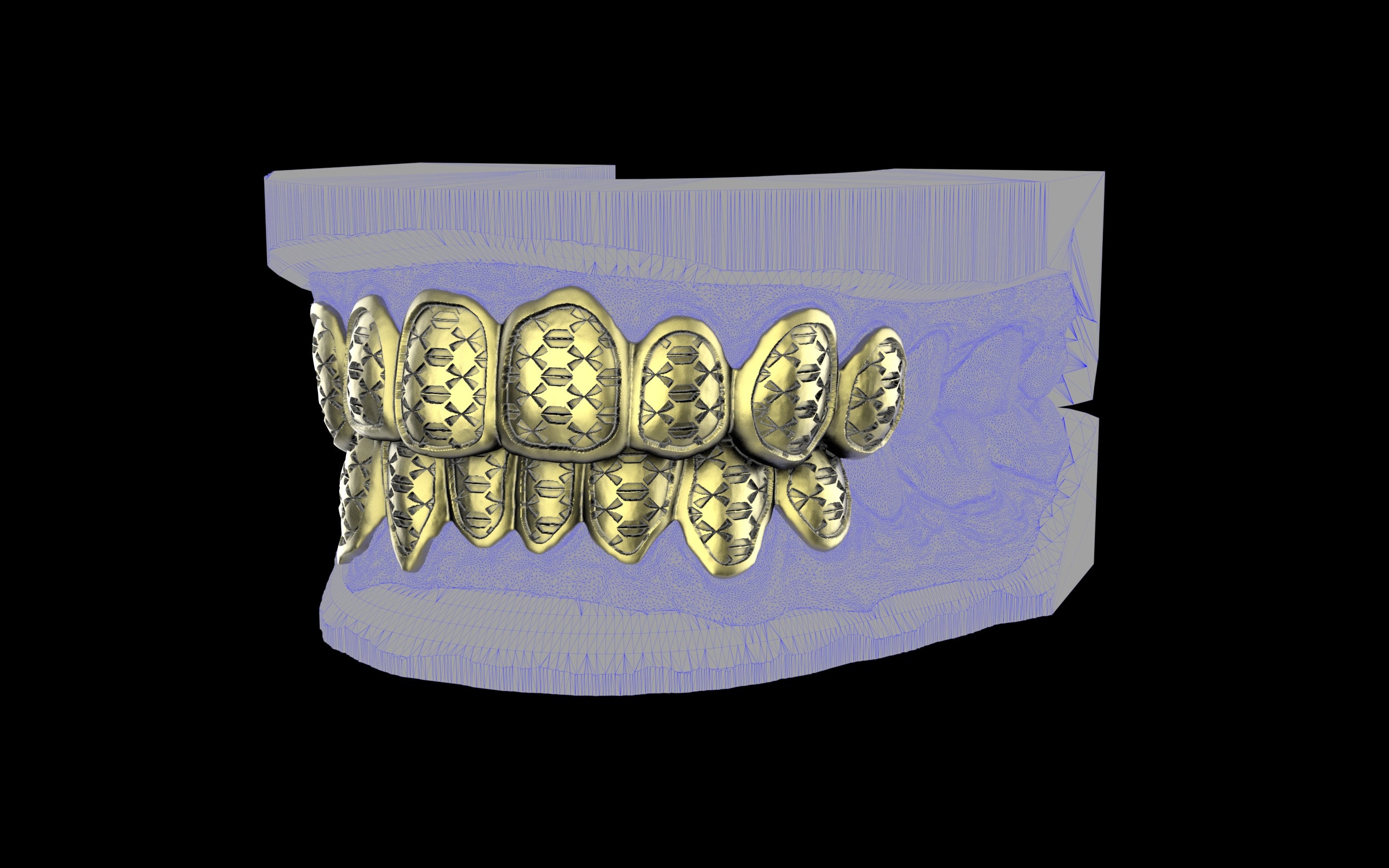 Custom Grillz / Tooth Caps - Funktion One