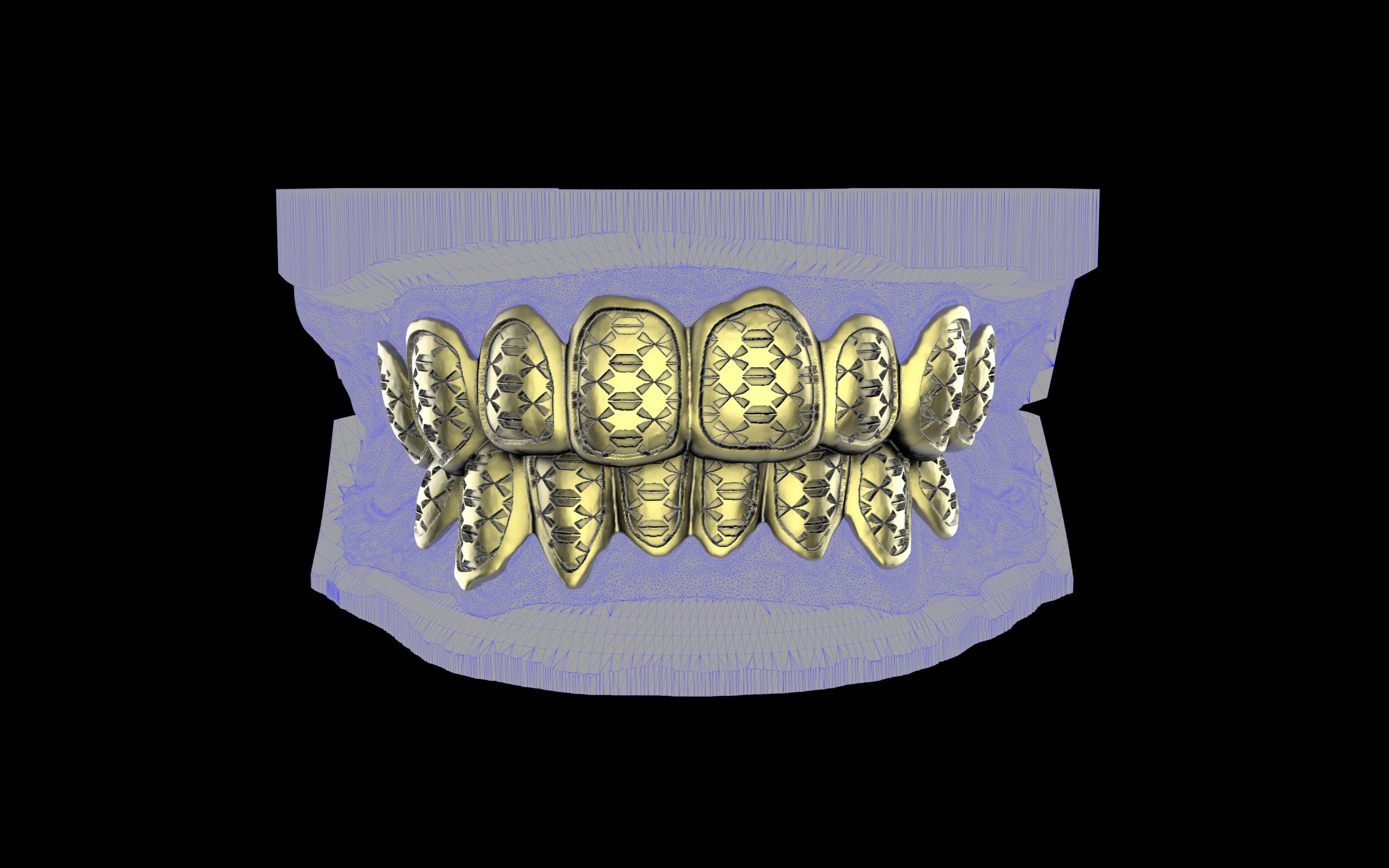 Custom Grillz / Tooth Caps - Funktion One