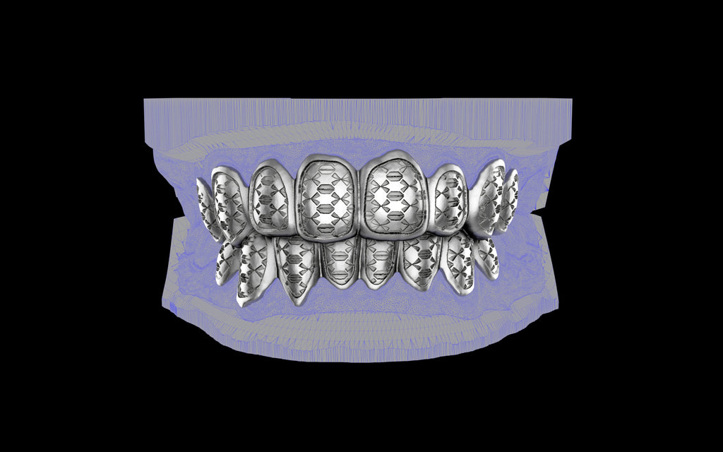 Custom Grillz / Tooth Caps - Funktion One