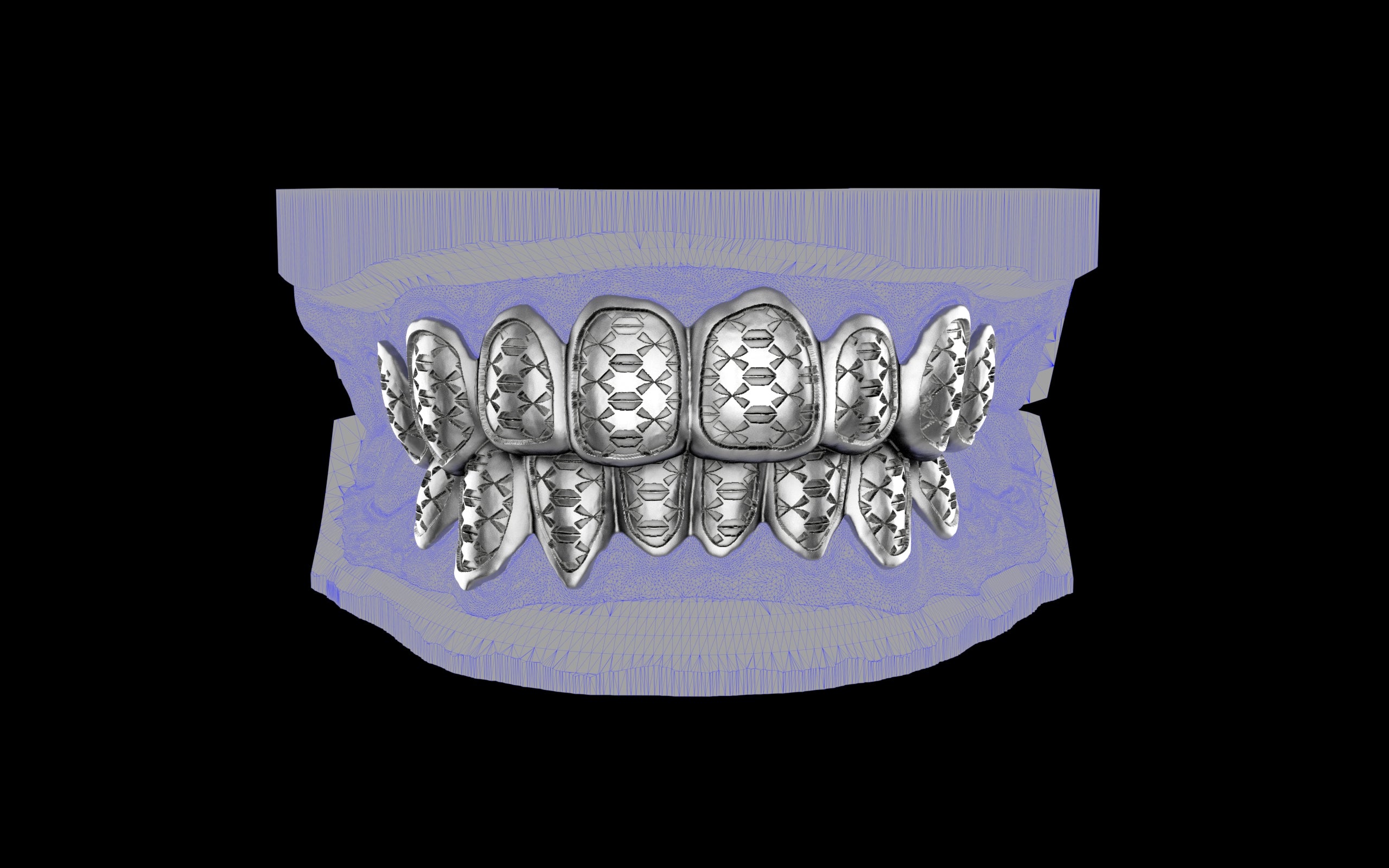 Custom Grillz / Tooth Caps - Funktion One