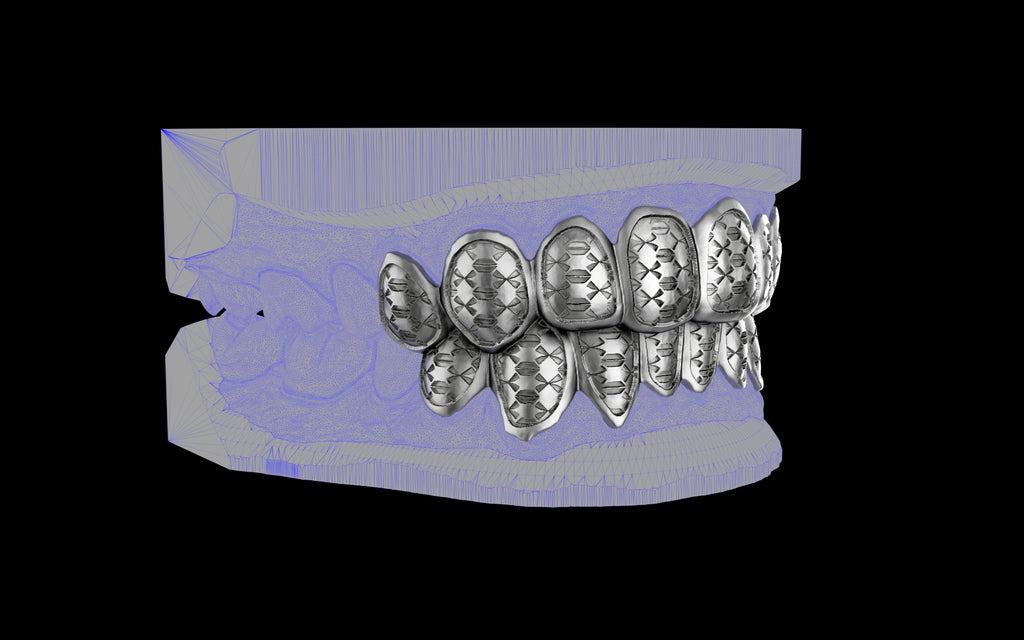 Custom Grillz / Tooth Caps - Funktion One