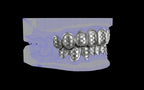 Custom Grillz / Tooth Caps - Funktion One
