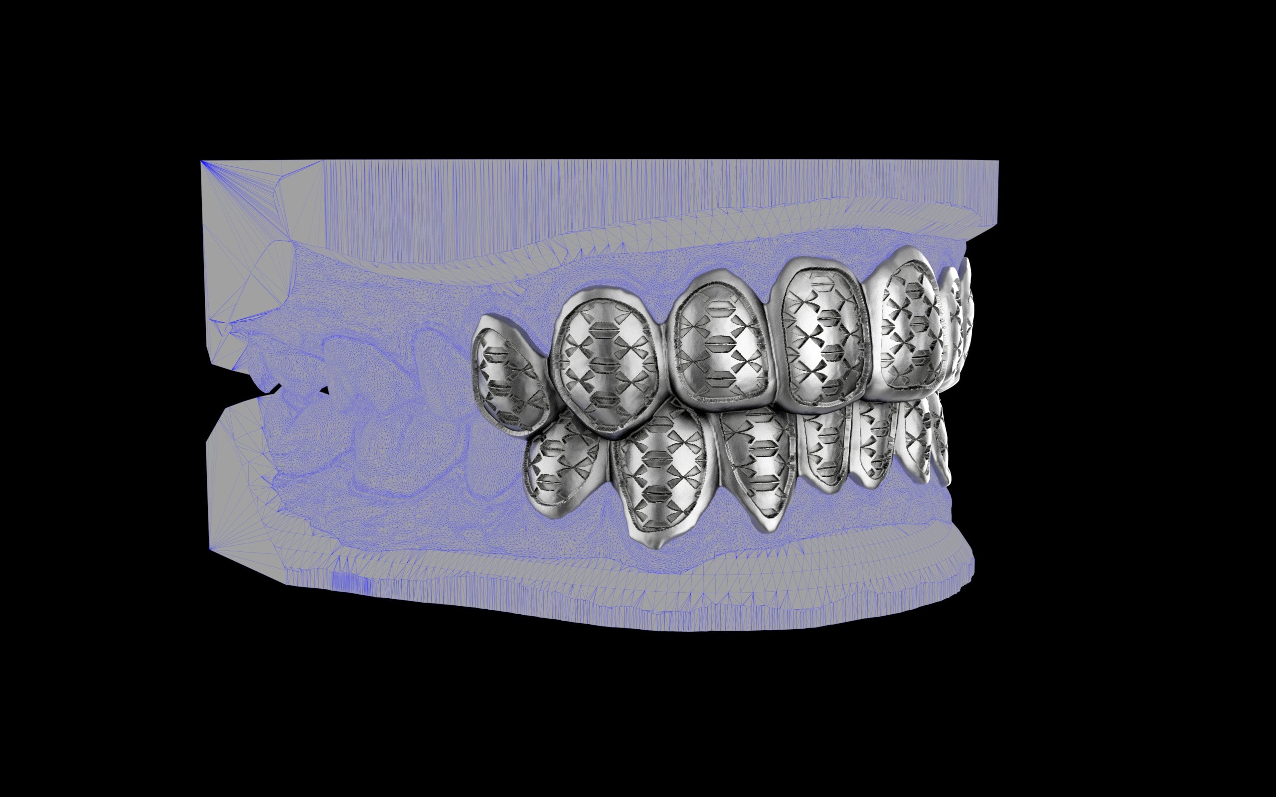 Custom Grillz / Tooth Caps - Funktion One