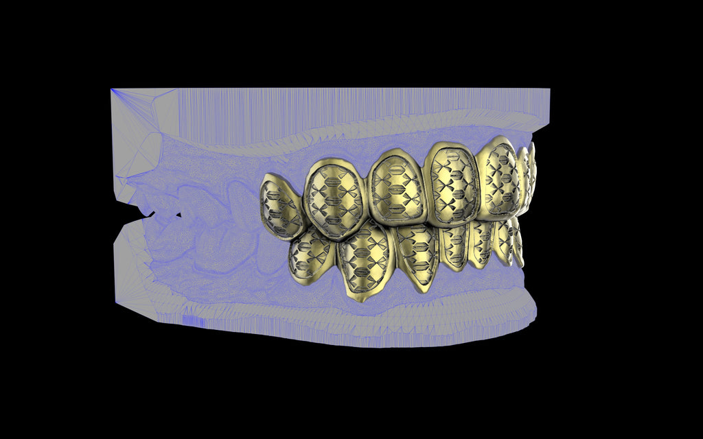 Custom Grillz / Tooth Caps - Funktion One