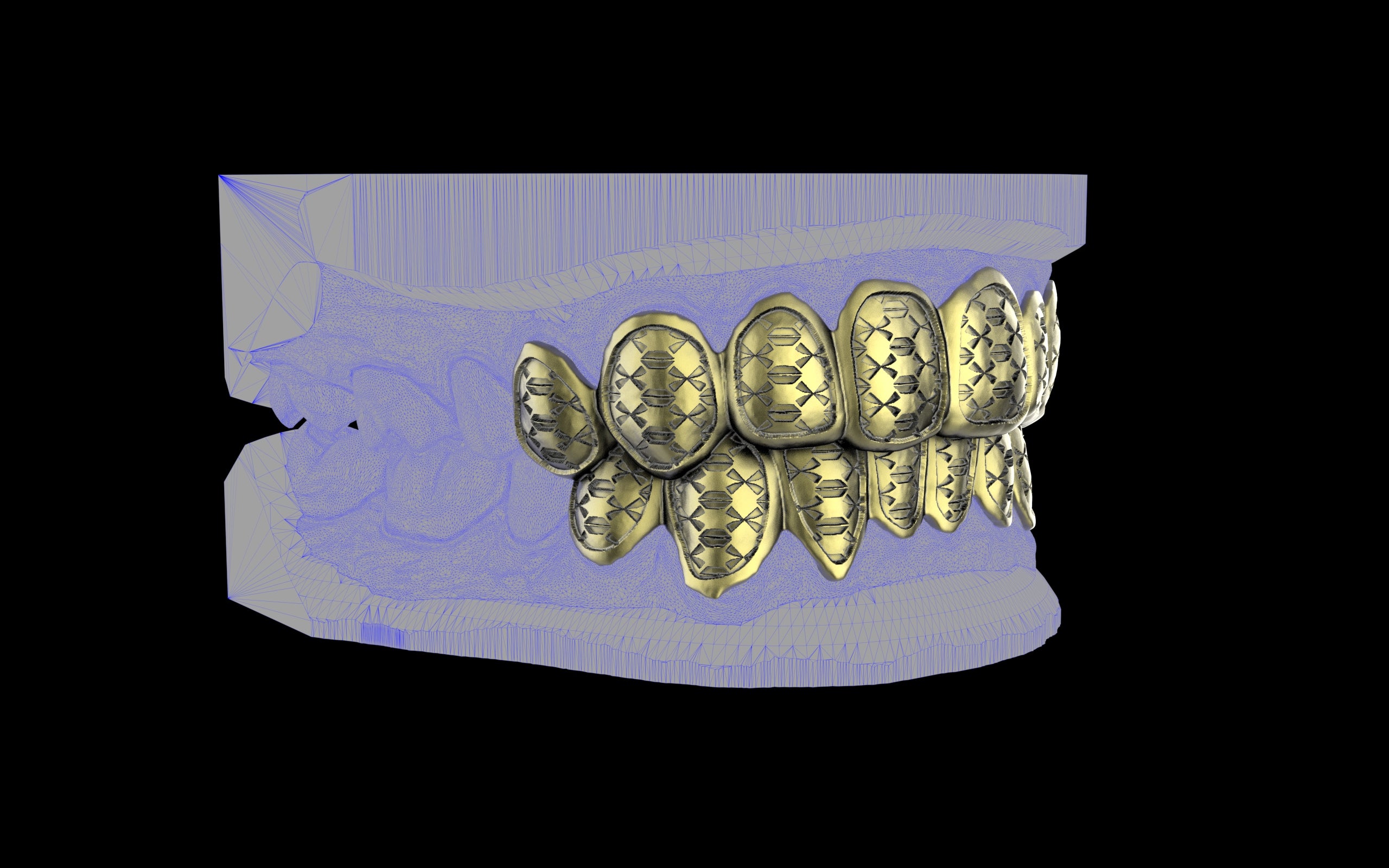 Custom Grillz / Tooth Caps - Funktion One