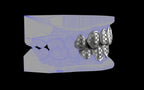 Custom Grillz / Tooth Caps - Funktion One
