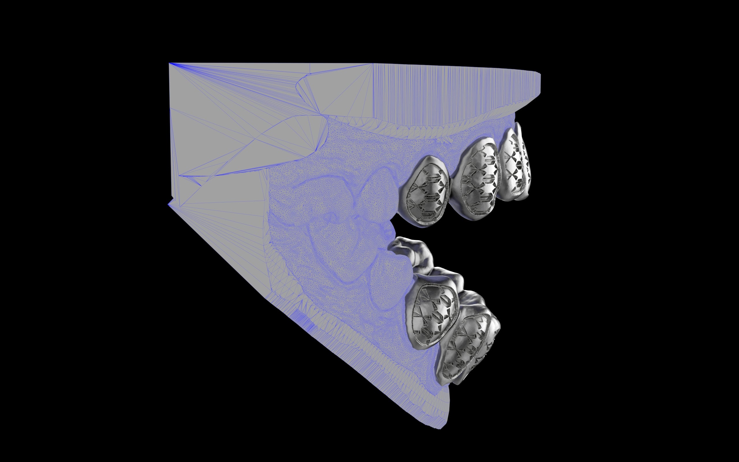 Custom Grillz / Tooth Caps - Funktion One