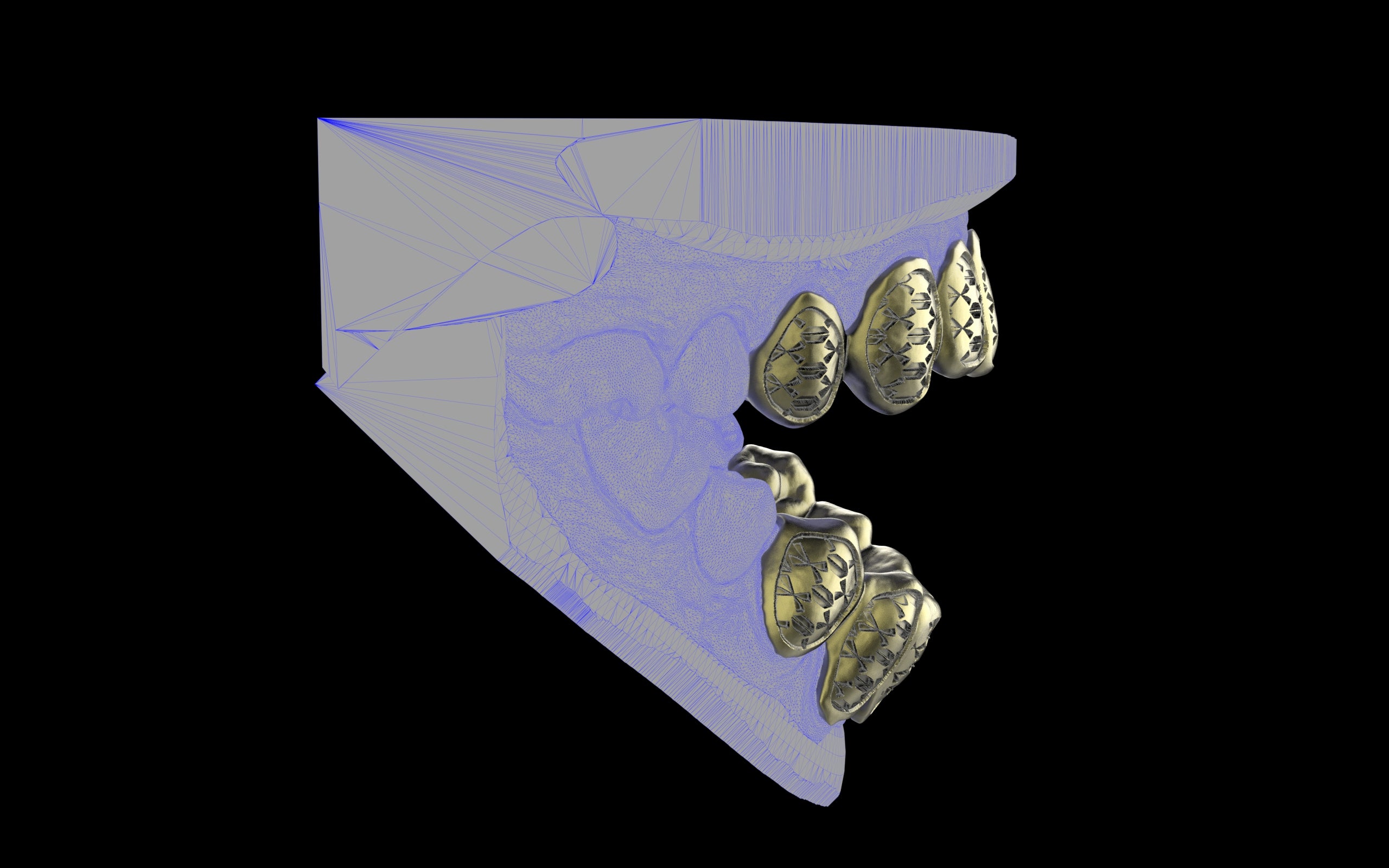 Custom Grillz / Tooth Caps - Funktion One